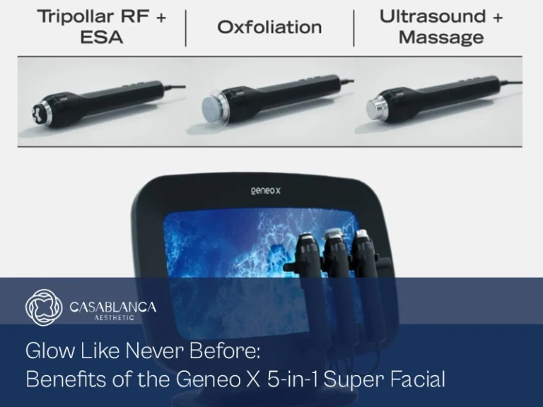 benefits-of-geneo-x