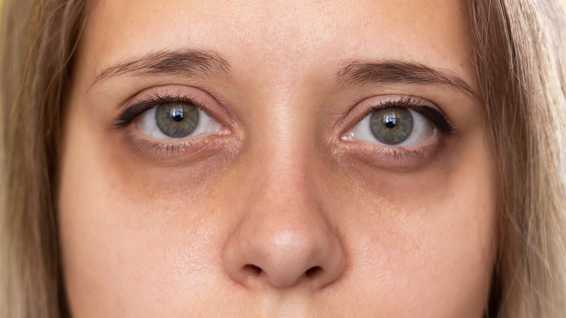 Dull and tired-looking skin