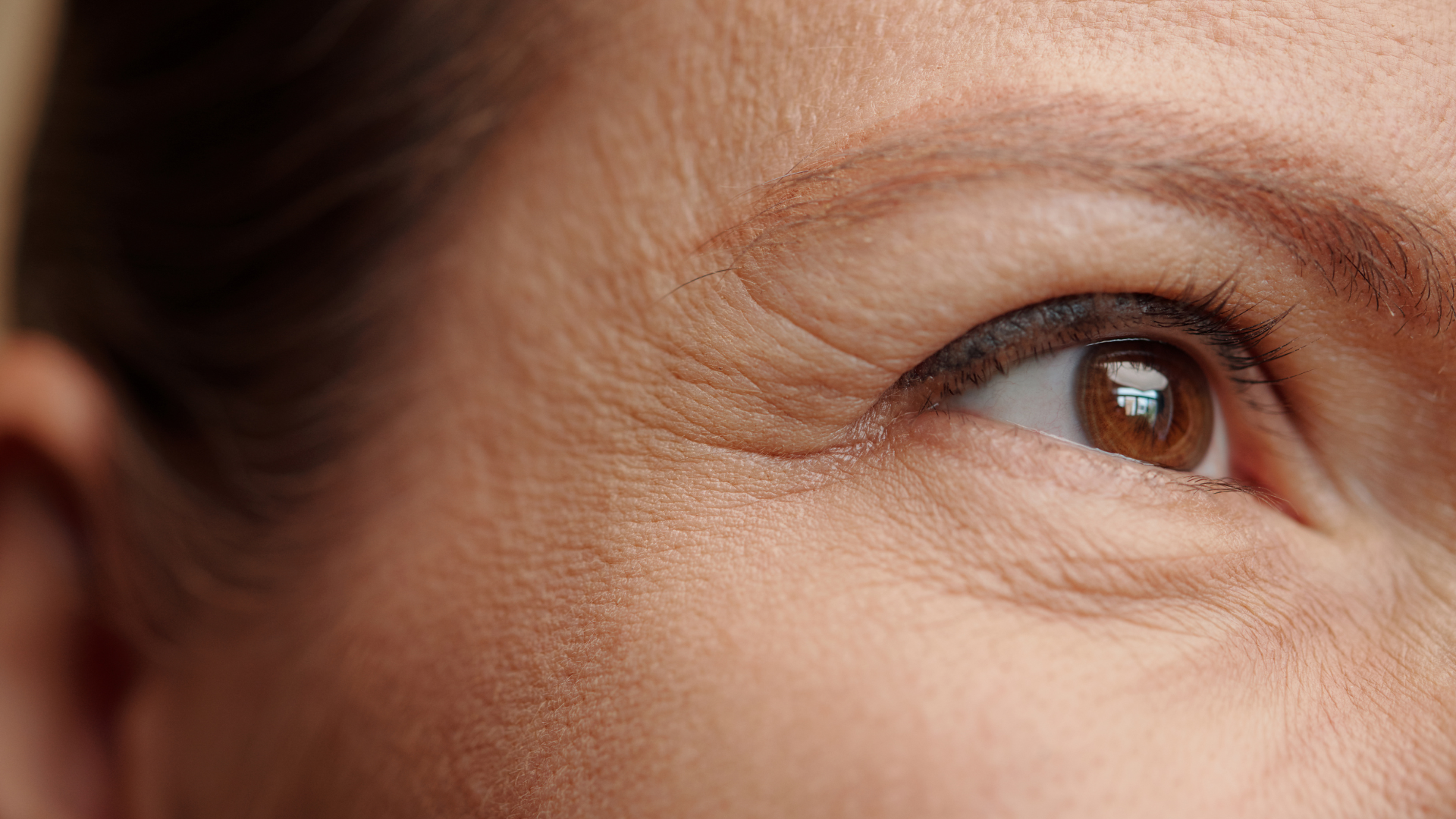 Fine lines on facial skin