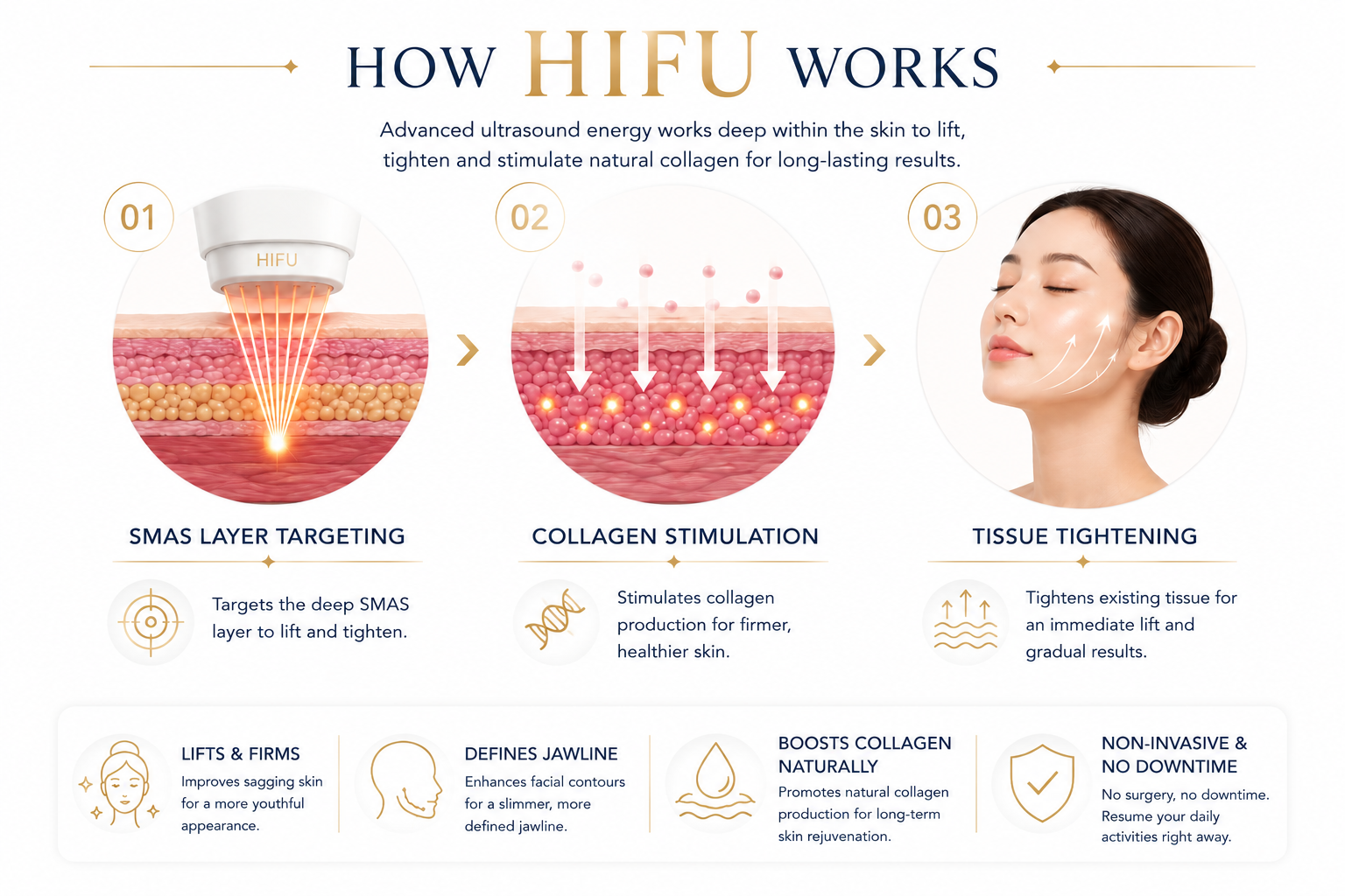 casablanca how hifu works