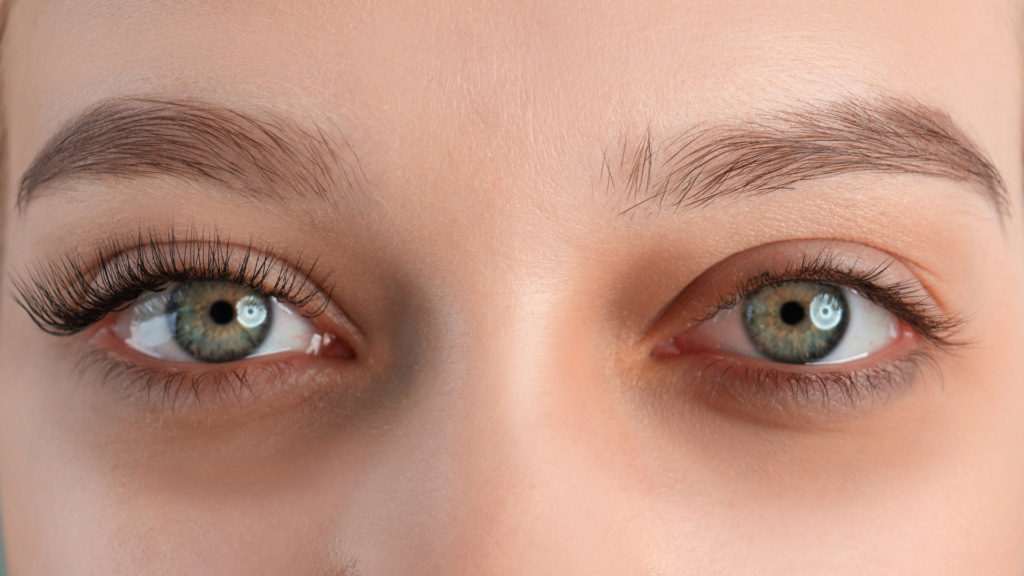 dark under eye