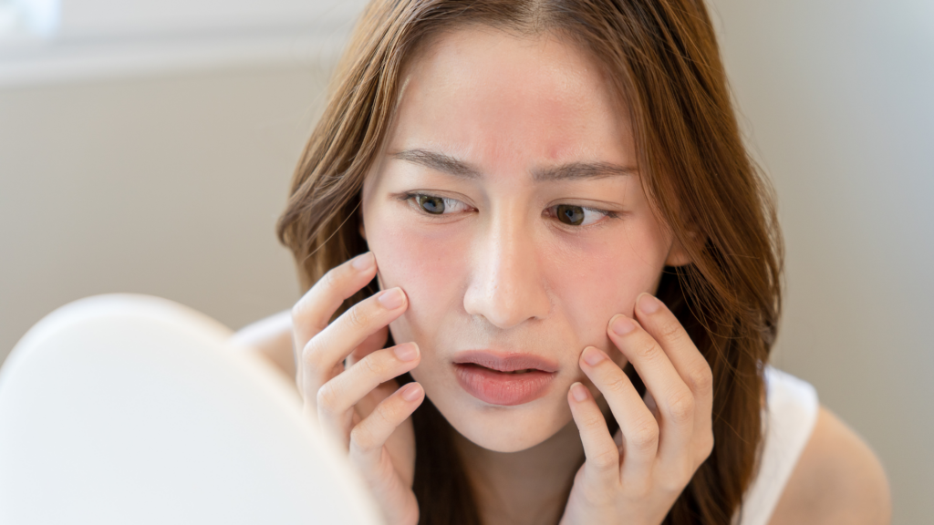 Sensitive or weakened skin barrier