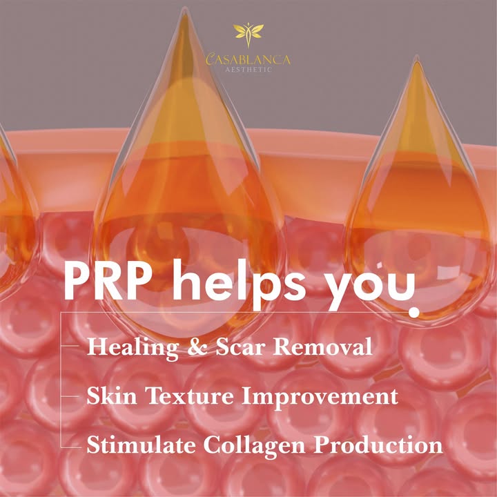 How PRP helps improve skin quality