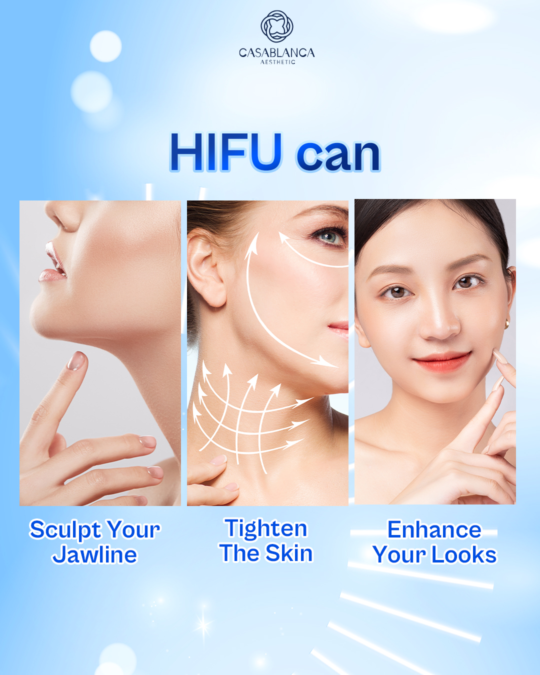 Rawatan HIFU lifting di Casablanca Aesthetic KL dan Petaling Jaya untuk mengangkat kulit tanpa pembedahan